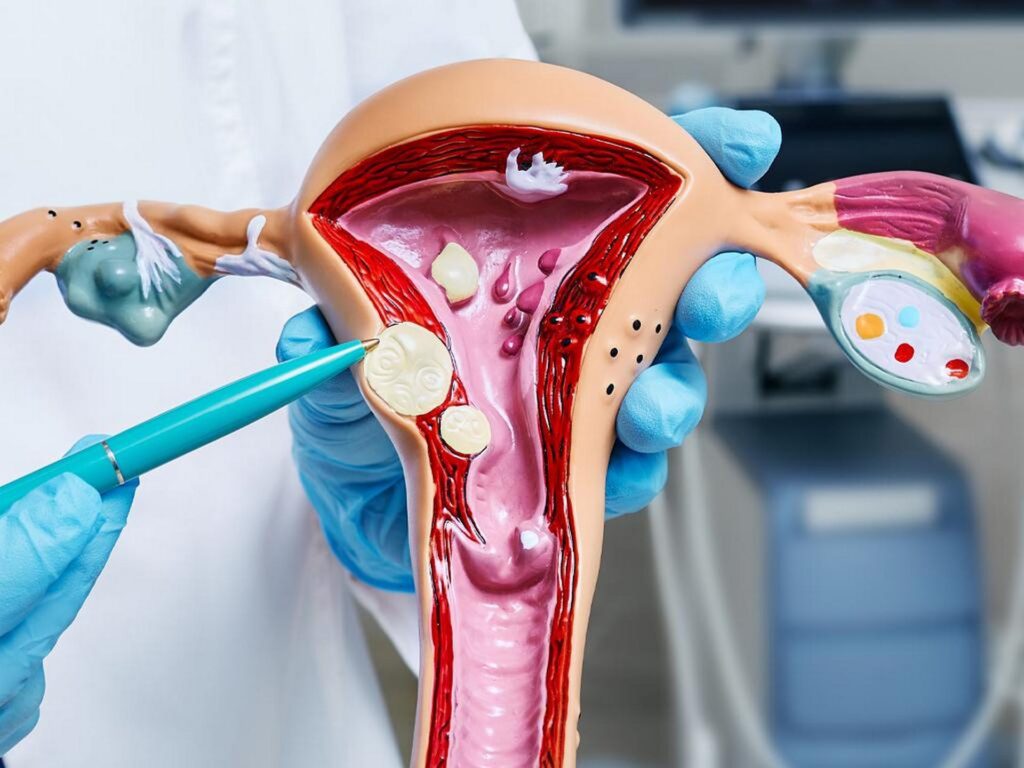 uterine fibroid awareness month